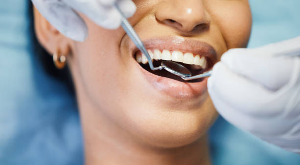 Best Emergency Dentist for Lost Fillings or Crowns in Eatonville, FL