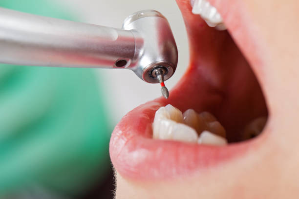 Best Broken or Cracked Tooth Emergency Dentist in Eatonville, FL